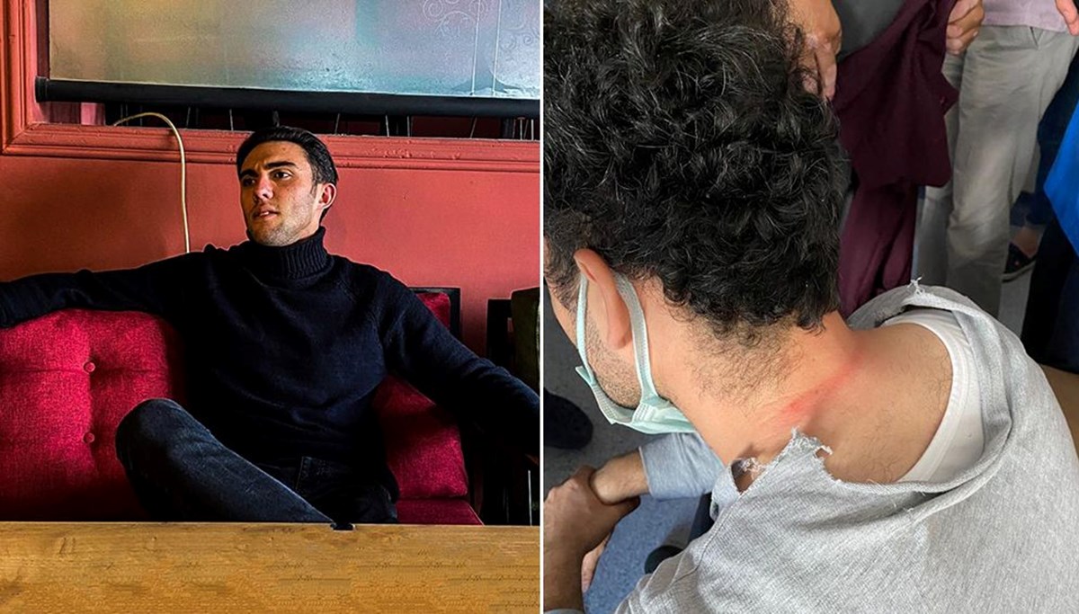 Ordu’da doktora saldırı: Şüpheli tutuklandı