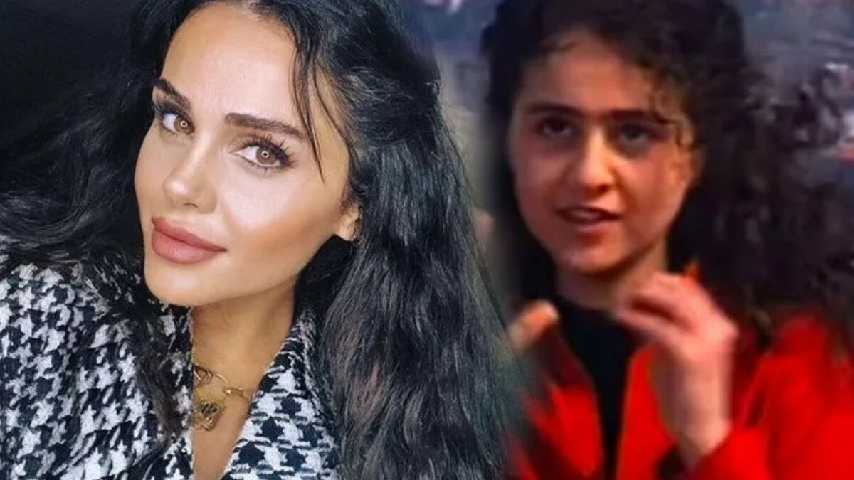 Azeri kızı Günel’den estetik açıklaması – En Son Haber