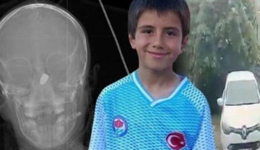 Trabzon’da Yorgun Merminin İsabet Ettiği,9 Yaşındaki Çocuk hayatını Kaybetti