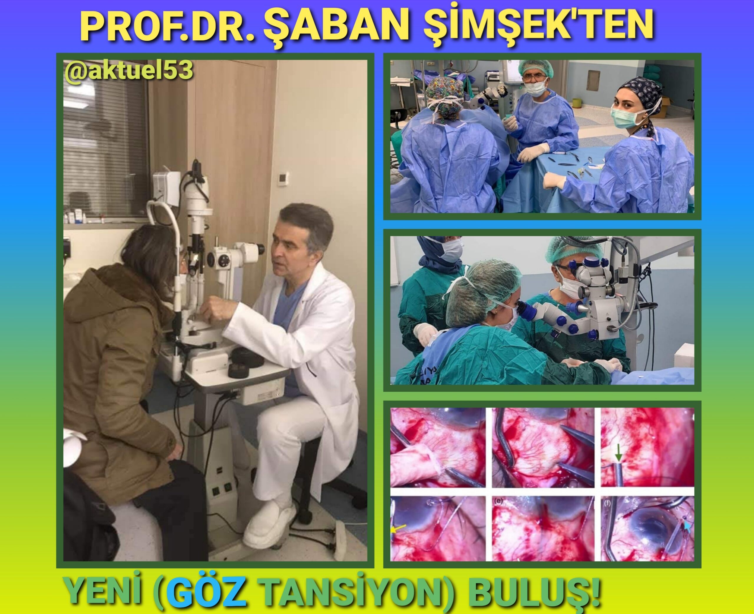 Rizeli Profesör Şaban Şimşek’in(göz Tansiyonu) Yeni tekniği,Dünya(literatür) Tıp tarihine geçti